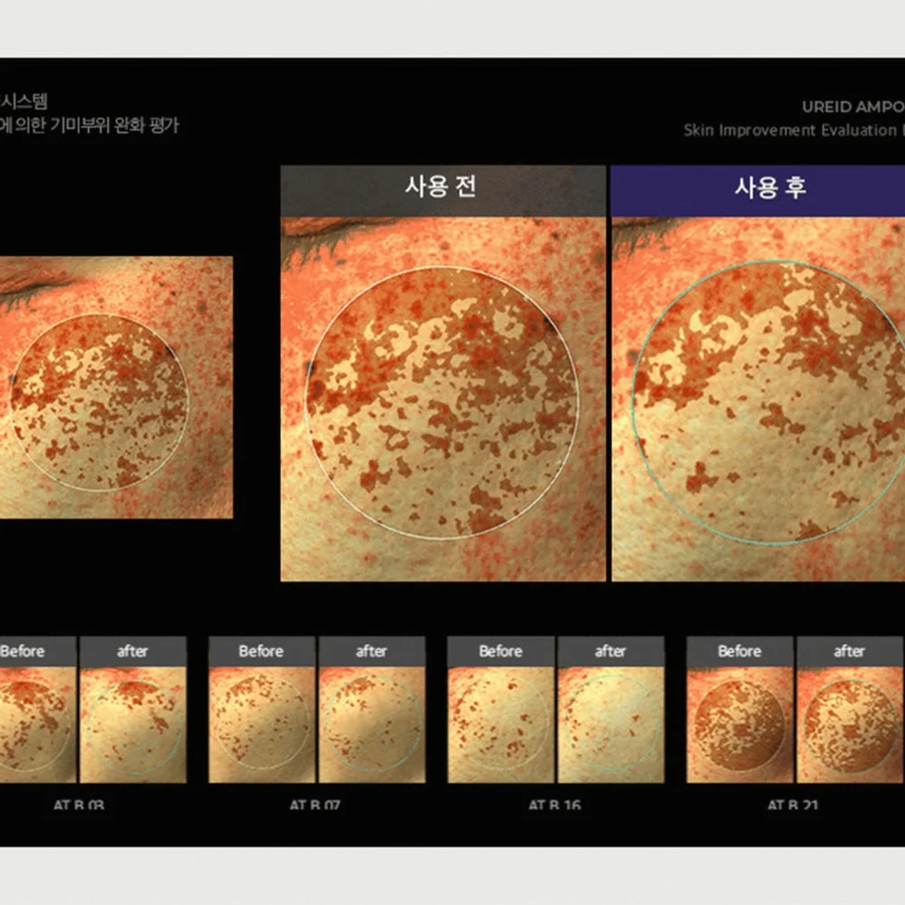 비에논 우레이드 기미앰플 검버섯 흑자 나이아신아마이드 미백앰플 상세 이미지 1