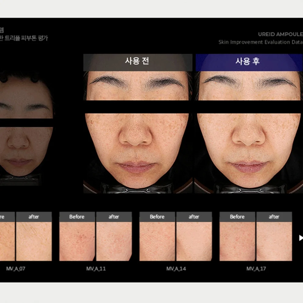 비에논 우레이드 기미앰플 검버섯 흑자 나이아신아마이드 미백앰플 상세 이미지 4