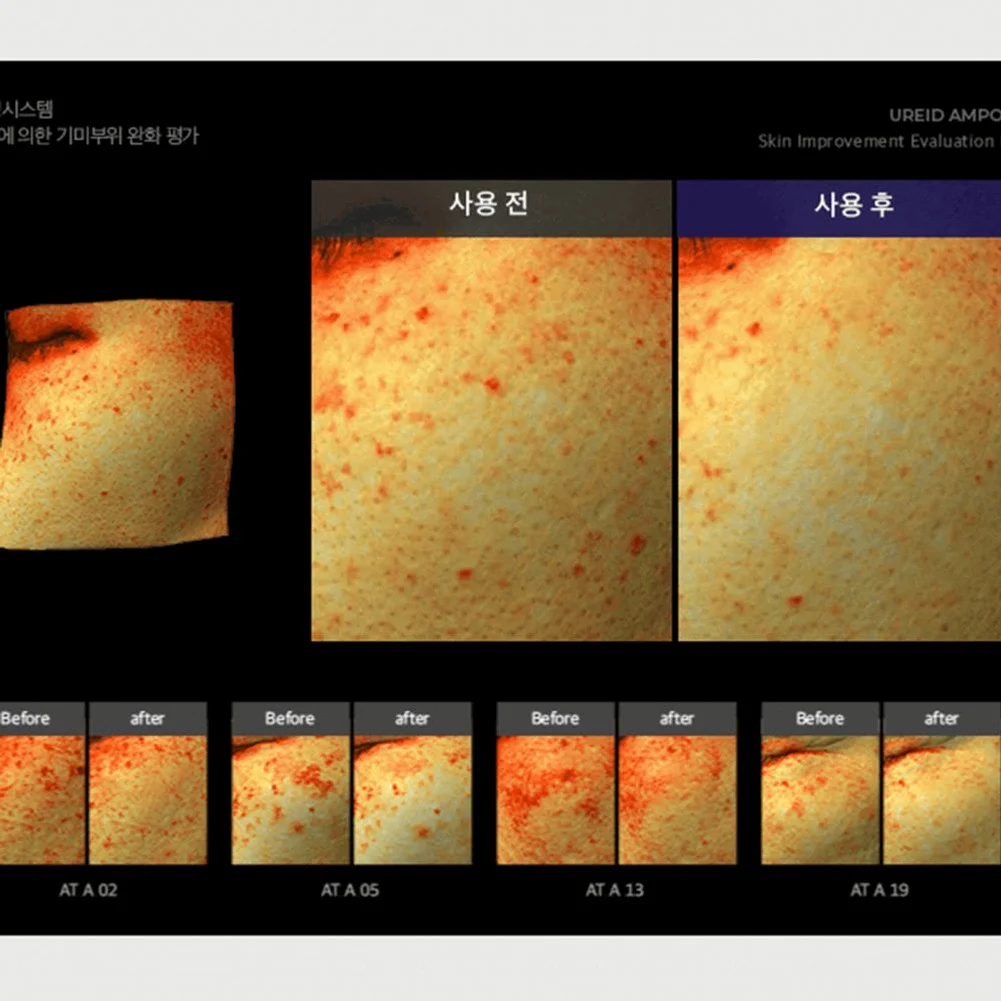 비에논 우레이드 기미앰플 검버섯 흑자 나이아신아마이드 미백앰플 상세 이미지 5