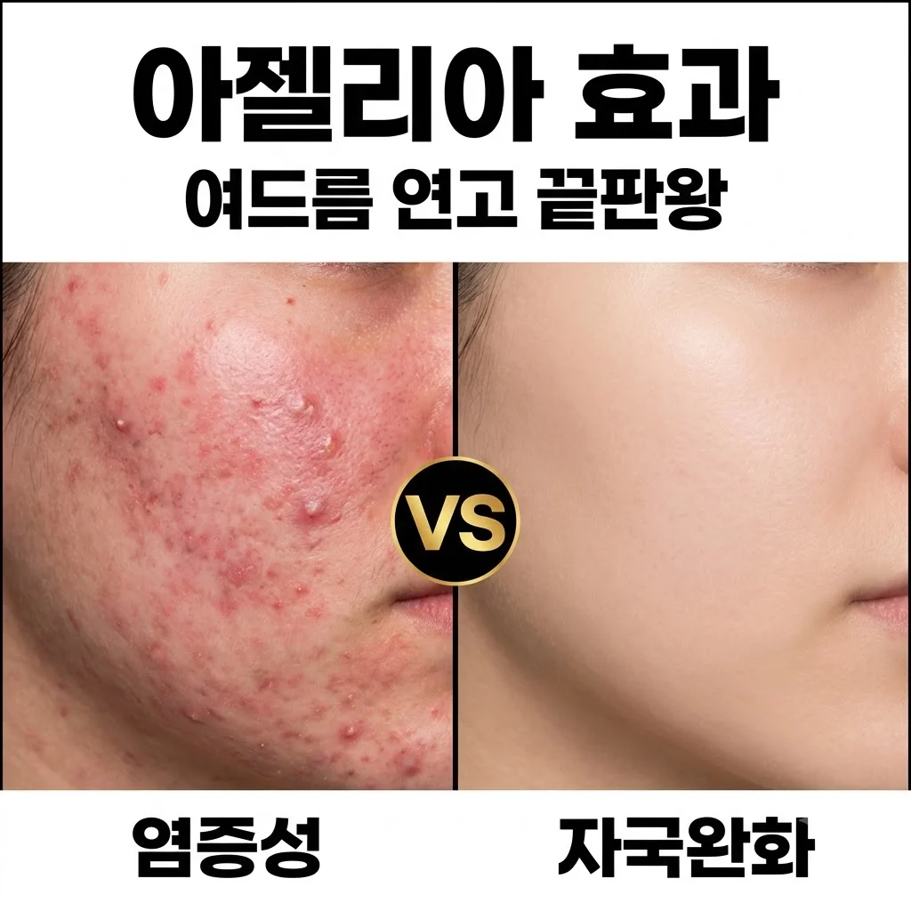 아젤리아크림 가격 파는곳 효과 사용법: 여드름 자국 따가움 총정리