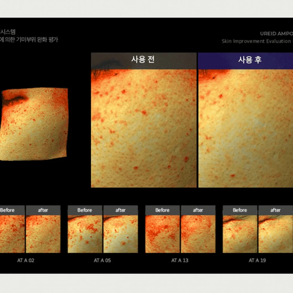 비에논 우레이드 기미앰플 검버섯 흑자 나이아신아마이드 미백앰플 상세 이미지 4